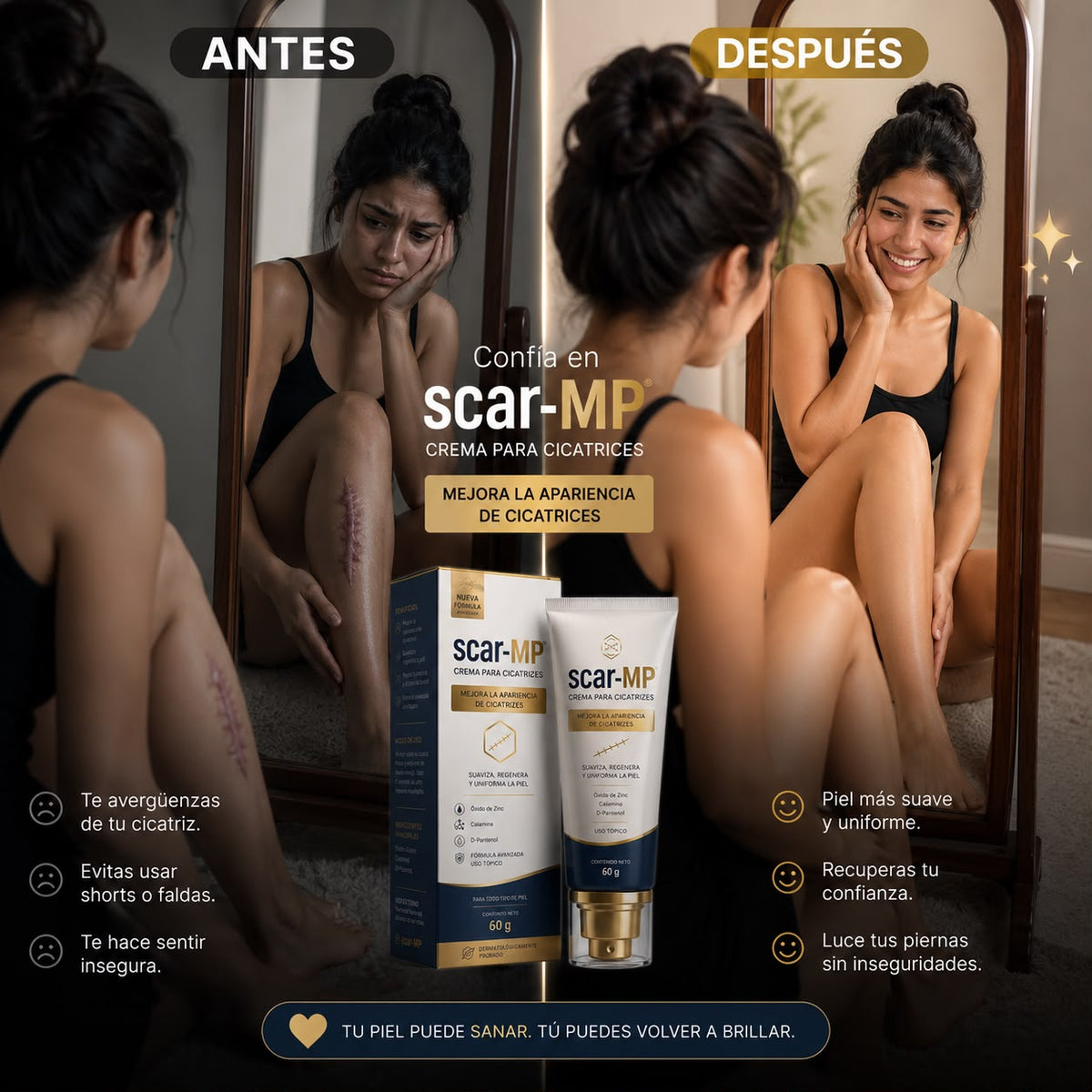 ¡SCAR-MP!™ - ELIMINA TUS CICATRICEZ RAPIDAMENTE✨
